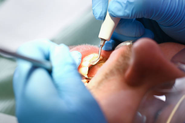 Best Knocked-Out Tooth Emergency  in Richwood, TX