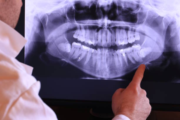 Best Chipped Tooth Repair Near Me  in Richwood, TX