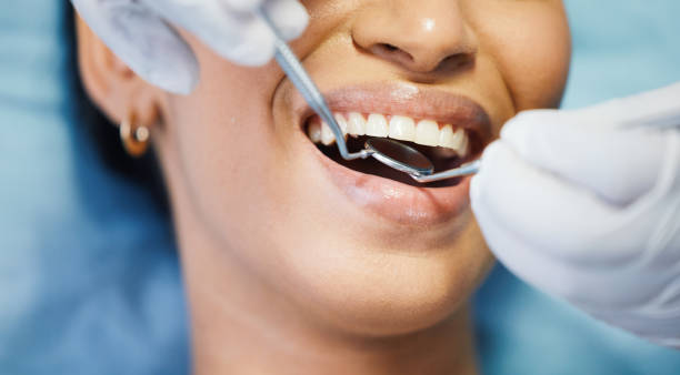 Best Cracked Tooth Emergency Dentist  in Richwood, TX